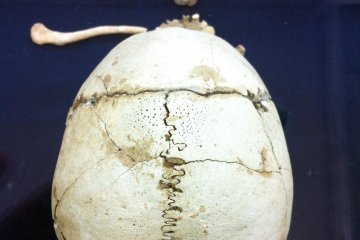 Skeleton of an adult female