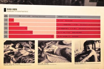 Victims of the bombing:&nbsp;Hiroshima Peace Memorial Museum