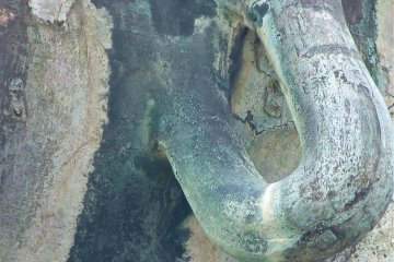 <p>Figure 4. Hole in earlobe</p>